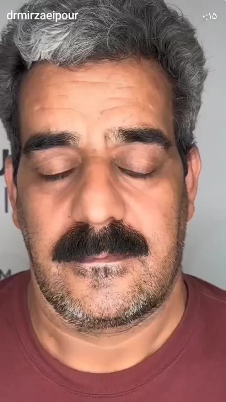 جشنواره تخفیف ویژه ایمپلنت دیجیتالی(جراح و متخصص)|خدمات آرایشگری و زیبایی|شهریار, شهریار|دیوار