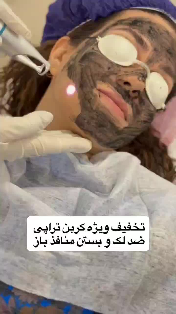 تخفیف پاییزی تنها مرکز تخصصی فیلر بادی نسیم شهر|خدمات آرایشگری و زیبایی|نسیمشهر, |دیوار