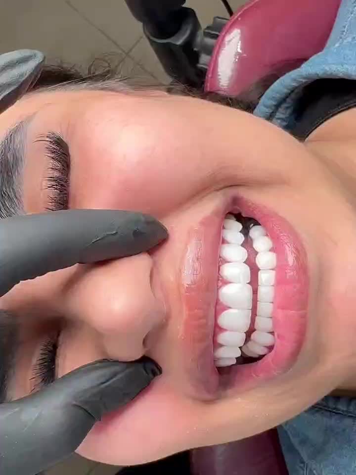 کامپوزیت دندان|خدمات آرایشگری و زیبایی|بوشهر, |دیوار