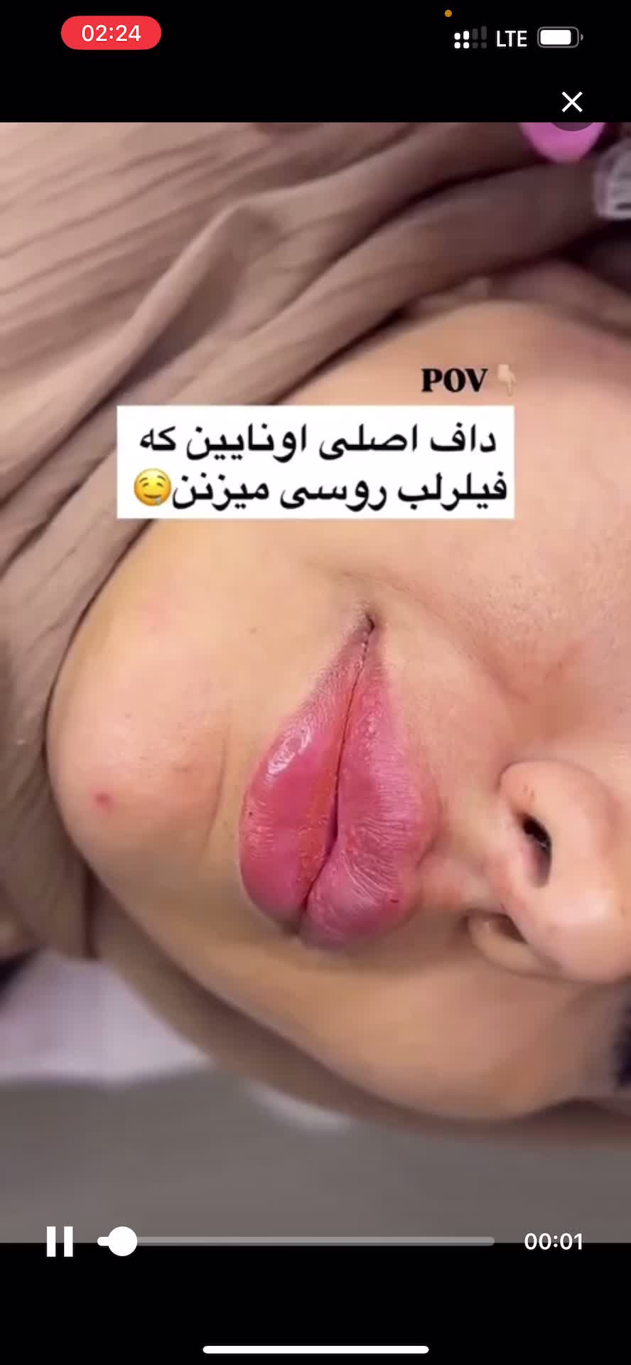 ژل و بوتاکس فقط ۳۹۰|خدمات آرایشگری و زیبایی|قم, زنبیل آباد|دیوار