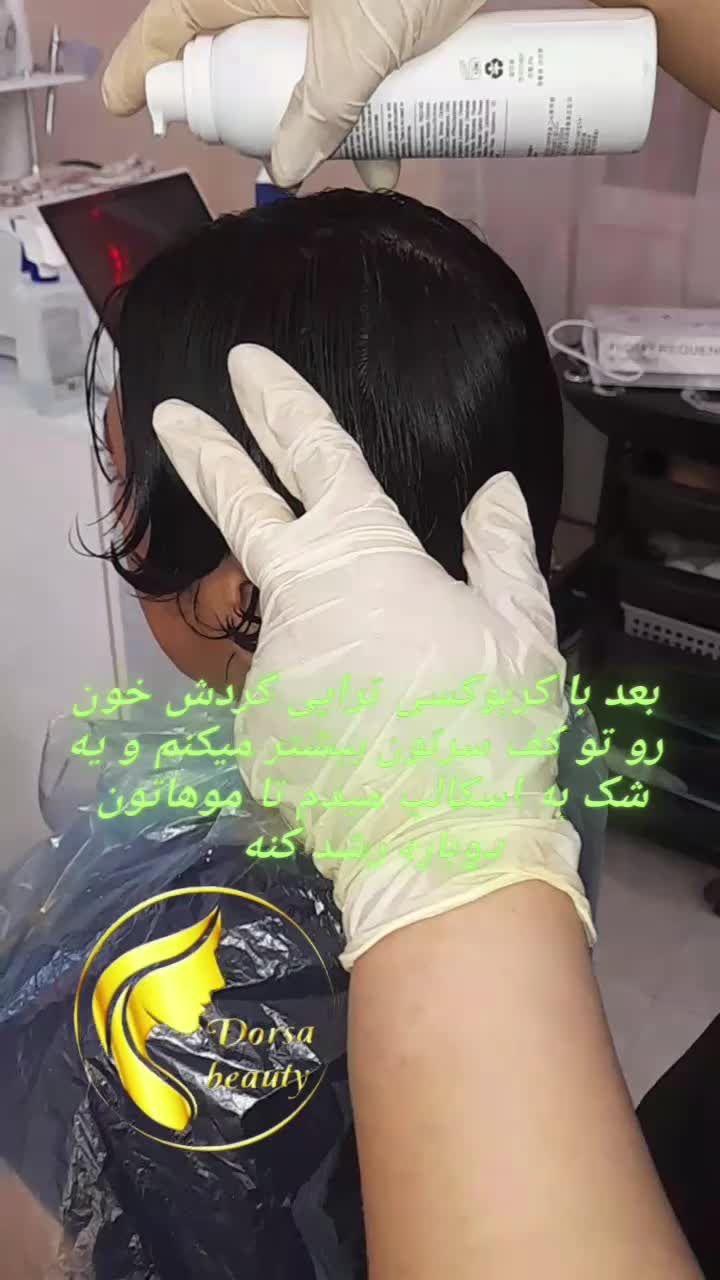 پاکسازی کف سر اسکراب اسکالپ|خدمات آرایشگری و زیبایی|مشهد, الهیه|دیوار