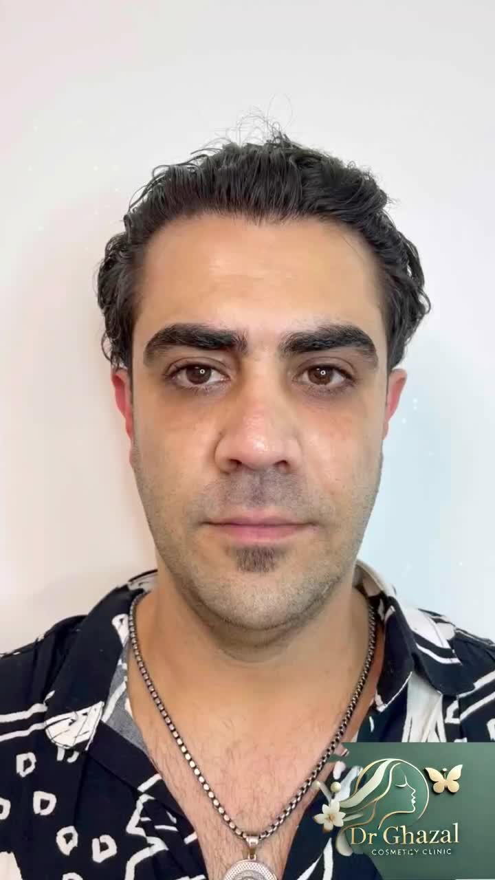 مدل خانم یااقا خوش چهره جهت تزریق فیلرو کانتورینگ|خدمات آرایشگری و زیبایی|تهران, فاطمی|دیوار