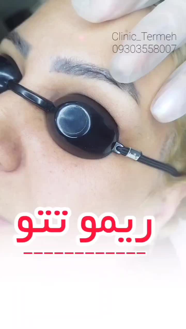 مرکز تخصصی ریمو ابرو، کک مک و خال|خدمات آرایشگری و زیبایی|کرج, شاهین‌ویلا|دیوار