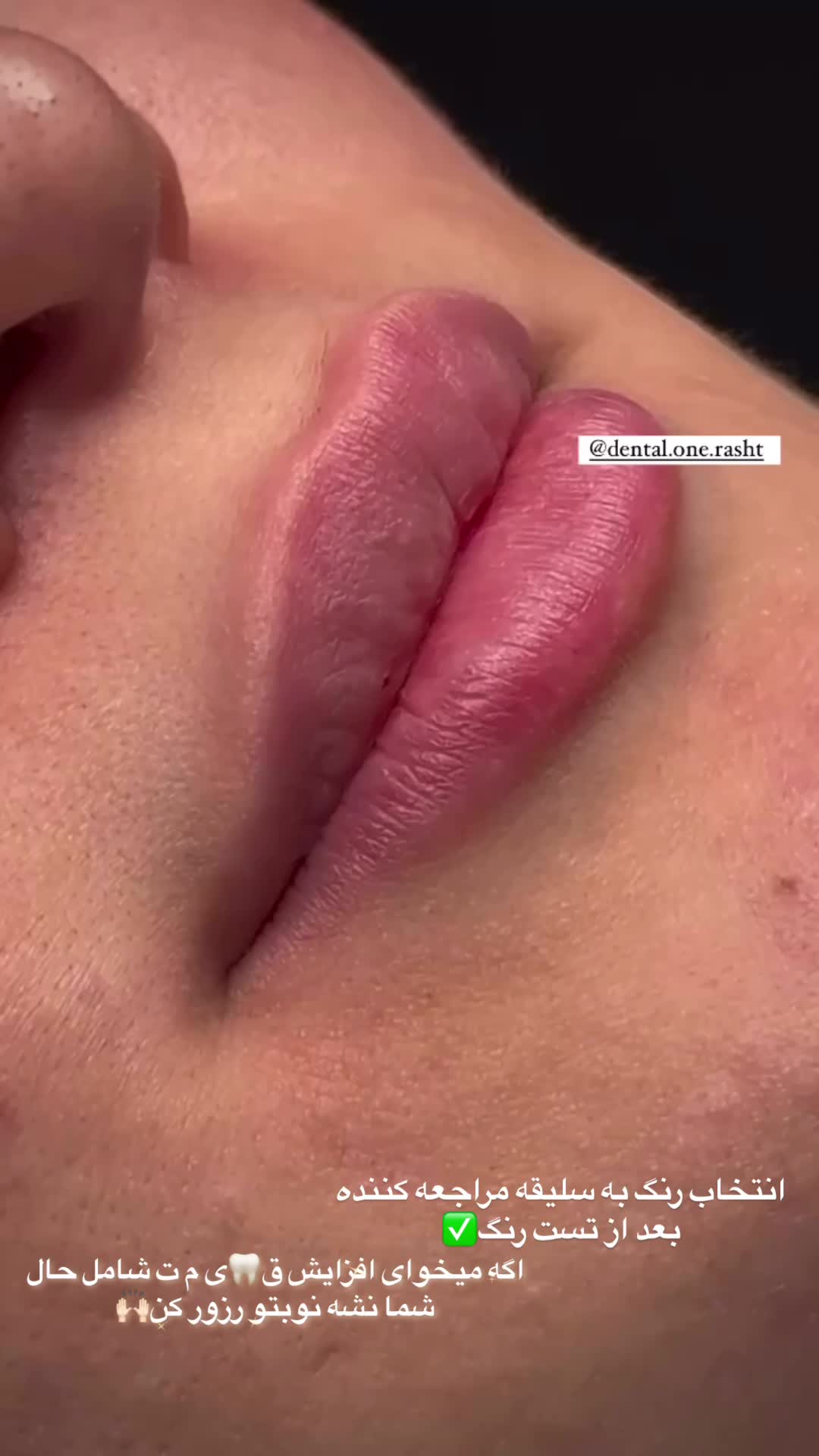 کامپوزیت|خدمات آرایشگری و زیبایی|رشت, گلسار|دیوار