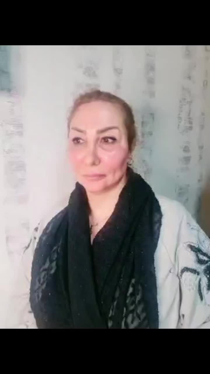 ساکشن غبغب تزریق چربی جراحی عمل بینی بایپس|خدمات آرایشگری و زیبایی|تهران, صادقیه|دیوار