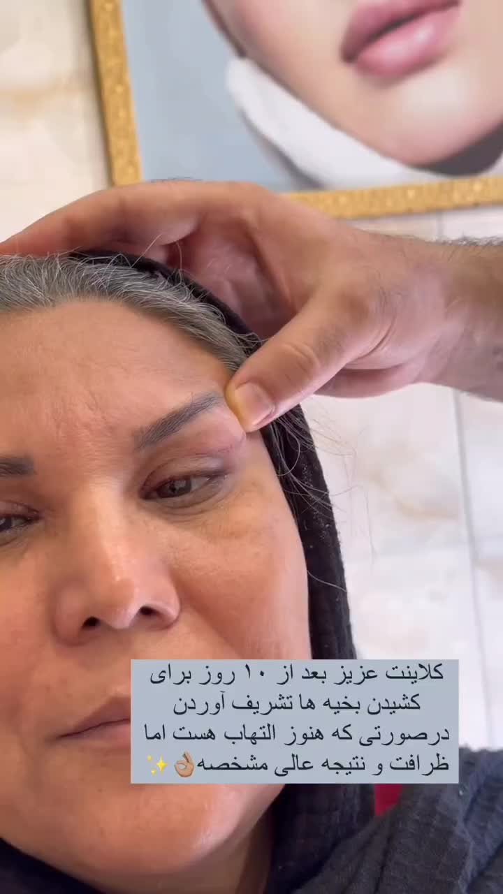 دستیار و اد جراحی زیبایی ، کارشناس اتاق عمل|خدمات آرایشگری و زیبایی|تهران, مرزداران|دیوار