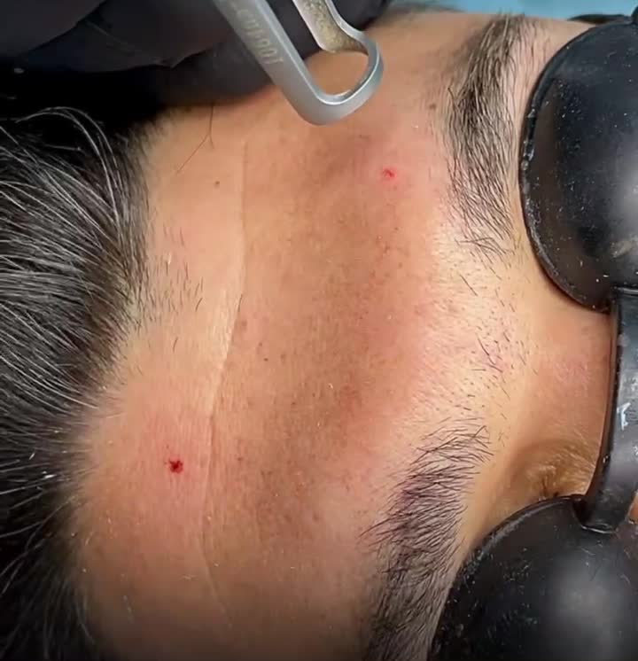 کلینیک رفع لک صورت کک و مک/لک بارداری/کربن تراپی|خدمات زیبایی و سلامت|مشهد, شهید فرامرز عباسی|دیوار