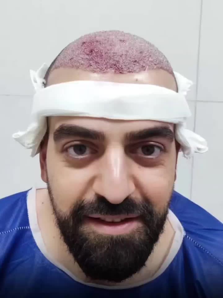 کاشت مو پرتراکم|خدمات آرایشگری و زیبایی|تهران, ونک|دیوار