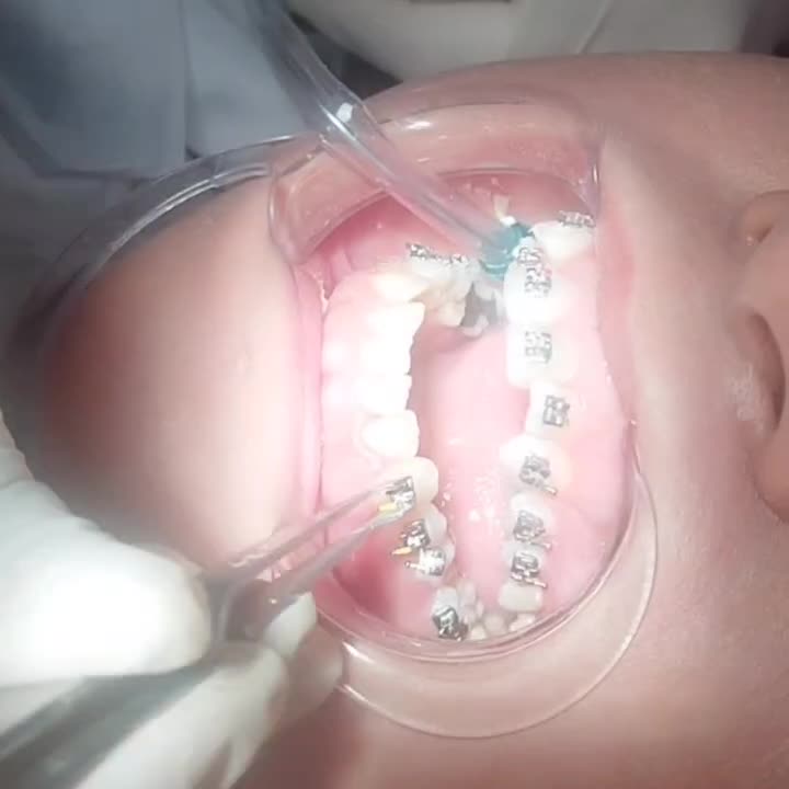 ارتودنسی ارزانتر از تعرفه نظام پزشکی،ایمپلنت فوری|خدمات آرایشگری و زیبایی|تهران, آذربایجان|دیوار