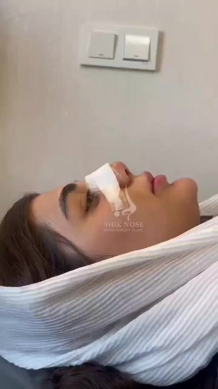 عمل جراحی بینی با تخفیف ویژه|خدمات آرایشگری و زیبایی|قم, باغ شازده|دیوار
