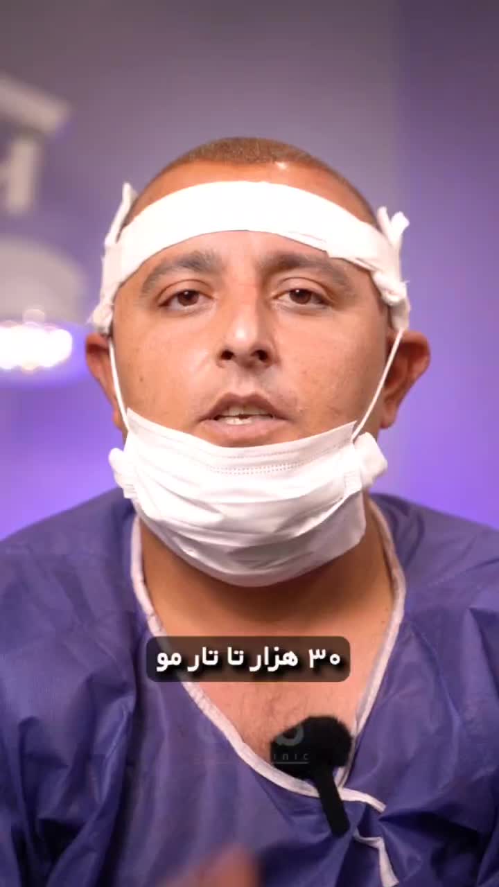 کاشت مو ابرو ریش تکنسین شیرازی|خدمات آرایشگری و زیبایی|قزوین, |دیوار