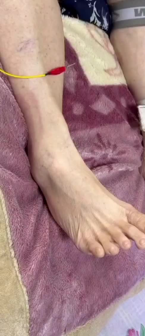 فیزیوتراپی در منزل|خدمات آرایشگری و زیبایی|کرمانشاه, |دیوار