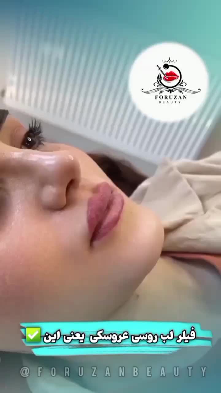 آفر(۷ روزه) ژل و بوتاکس فولادشهر|خدمات آرایشگری و زیبایی|فولادشهر, فولادشهر|دیوار