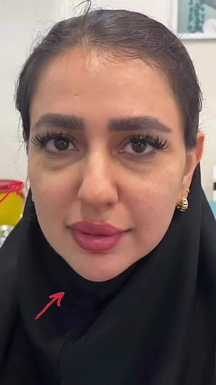 خدمات پوست و مو توسط پزشکان حرفه ای و مجرب|خدمات زیبایی و سلامت|تهران, سازمان برنامه شمالی|دیوار