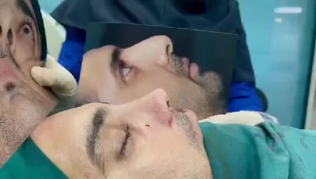 زیبایی بینی|خدمات آرایشگری و زیبایی|تهران, فاطمی|دیوار