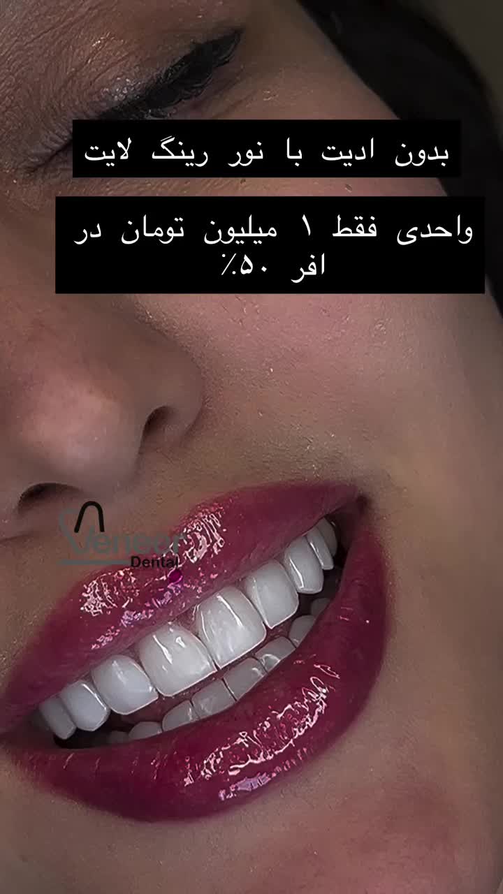 دندانپزشکی دنتال ونیر کامپوزیت لمینت ایمپلنت|خدمات آرایشگری و زیبایی|تهران, تجریش|دیوار